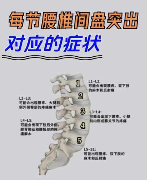 腰椎图片构造图解大全缩略图