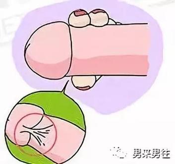 最有效的延时方法缩略图