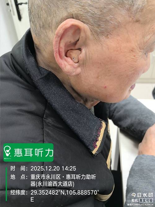airpods总是断断续续缩略图