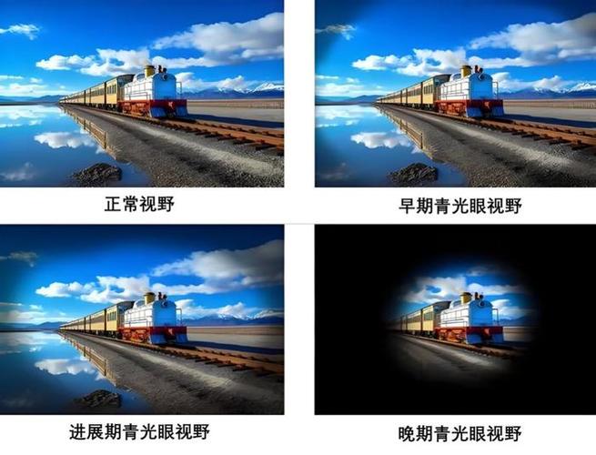 摄像头周围发黄缩略图