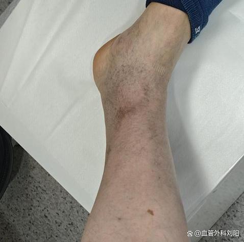 沈阳下肢血管外科最好的医院排名缩略图