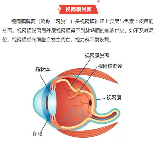 眼睛模糊怎么恢复缩略图