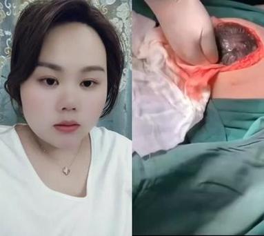 孕妇临产难产猛按肚子视频游戏截图
