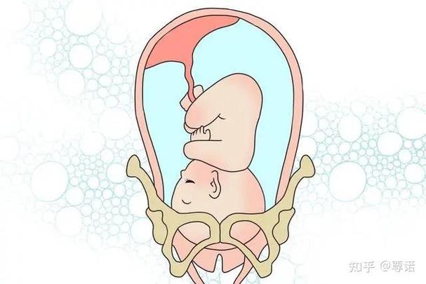 孕妇怀了65个胞胎游戏截图