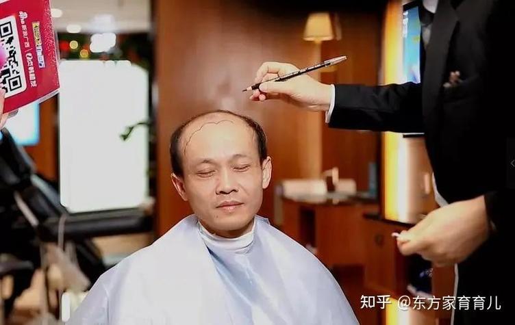 太原植发最好的医院是哪个缩略图