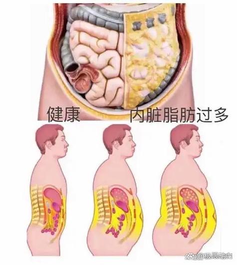 内脏脂肪怎么减最有效的方法游戏截图