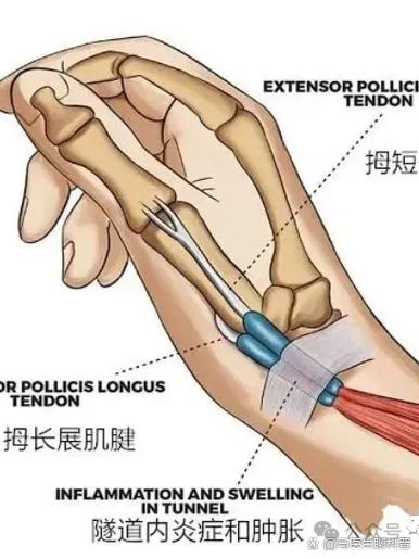 手卡顿一招恢复游戏截图