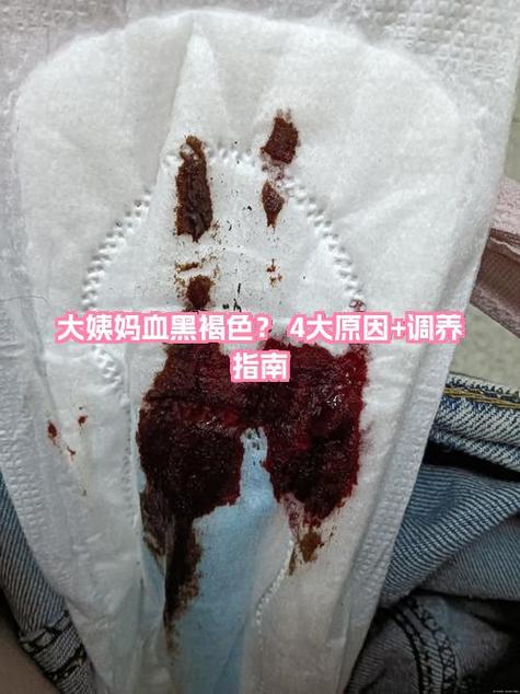 姨妈走后几天容易怀孕缩略图