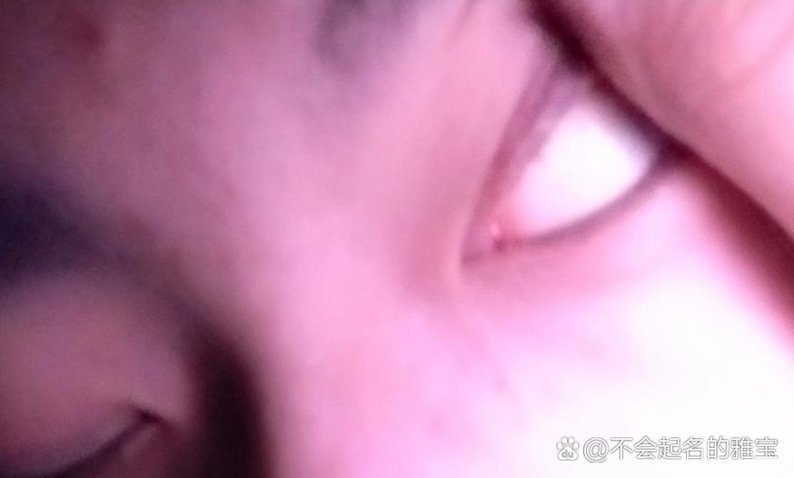 眼睛翻白眼是什么原因缩略图