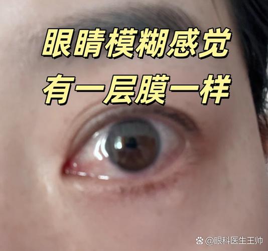 眼睛有一层蒙是什么原因缩略图