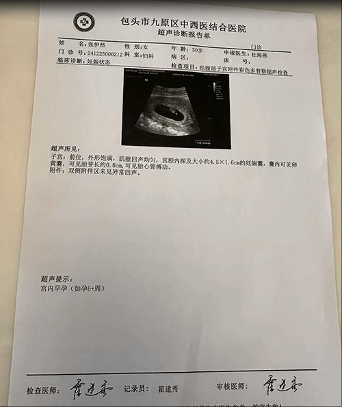b超怀孕单子图片真实游戏截图