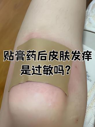 膏药贴后用什么方法能洗掉缩略图