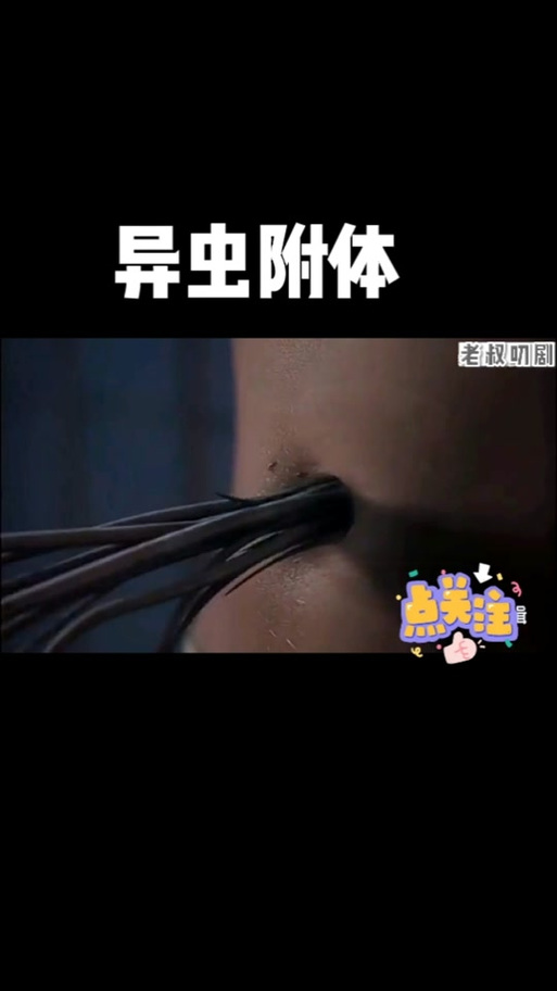 寄生虫从屁股进入女性肚子寄生变异缩略图