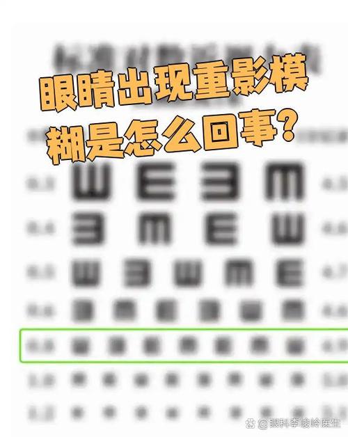 眼睛视力模糊什么原因造成的游戏截图