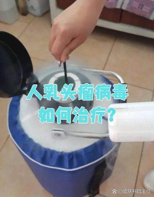 hpv物理治疗怎么治疗游戏截图