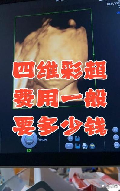 检查四维要多少钱缩略图