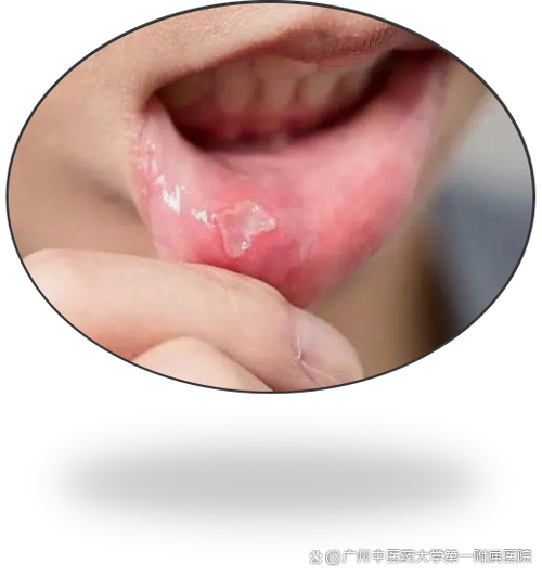 沈阳看口腔溃疡哪个医院好游戏截图