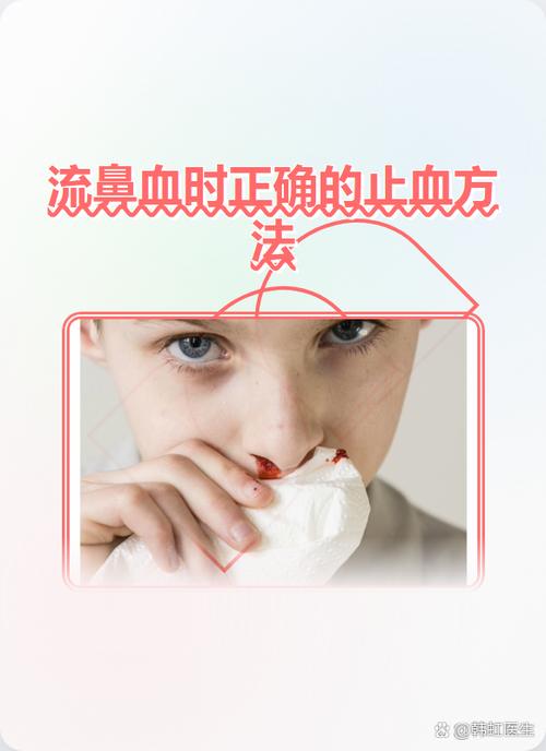 治疗流鼻血的特效药缩略图