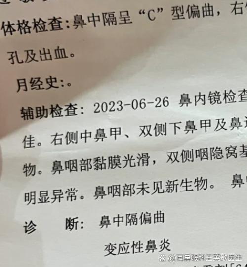 流鼻血需要做几样检查图标