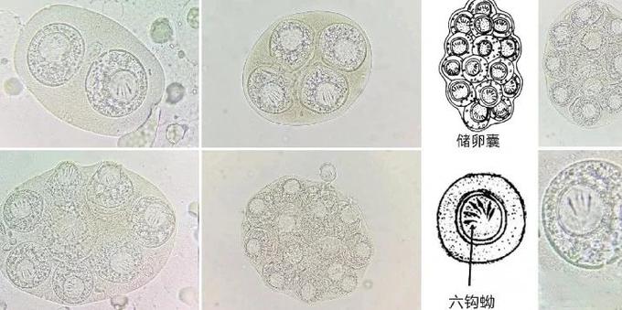 粘液寄生虫从屁股钻进去寄生缩略图