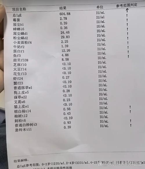 过敏源ige高是怎么回事缩略图