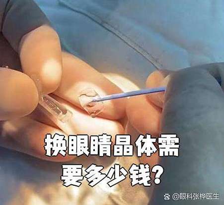 换眼球大概需要多少钱缩略图