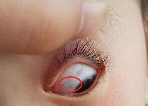 眼睛有蓝点是什么原因?游戏截图