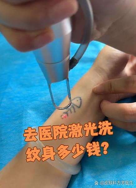 去医院洗纹身多少钱游戏截图