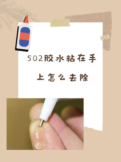 衣服粘到502胶水怎么洗掉?缩略图