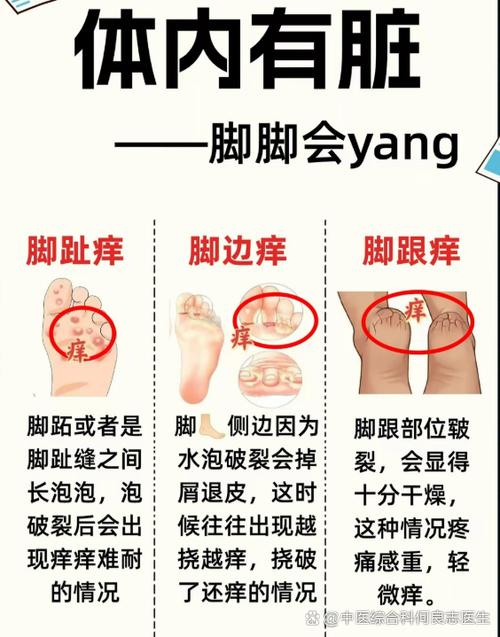 脚底老是痒是得什么病