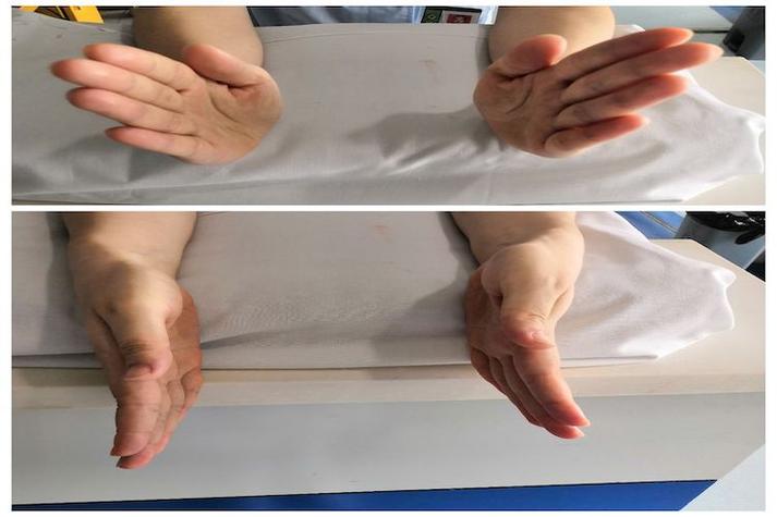手腕康复训练视频教程缩略图