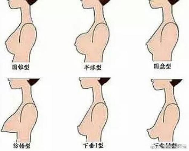 乳房有哪些类型缩略图