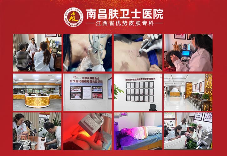 青春痘去哪个医院看好缩略图