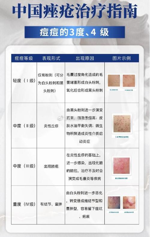 去医院看痘痘大概要多少钱游戏截图