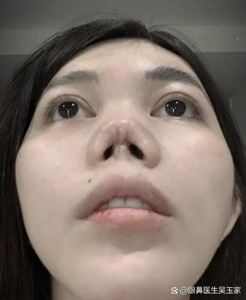 面容修复多少钱游戏截图