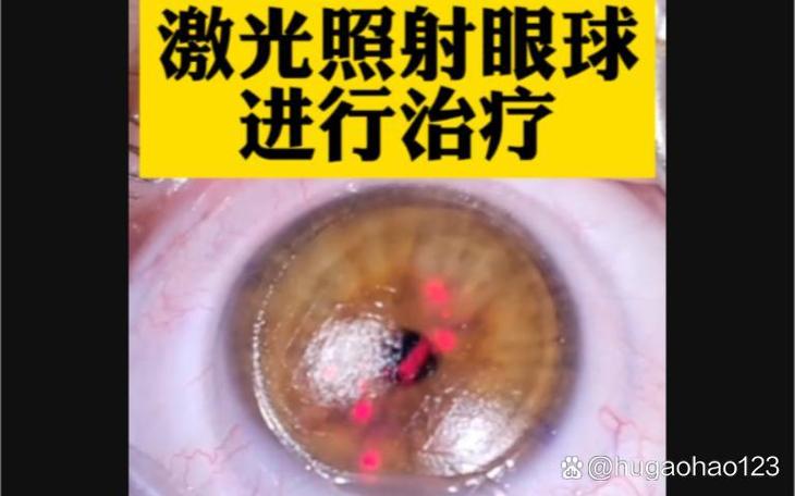 激光伤眼睛怎么办游戏截图