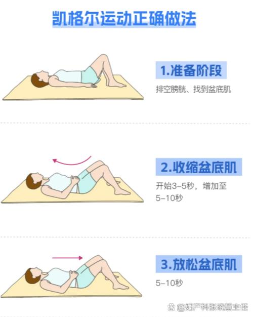 凯格尔盆底肌训练教程缩略图