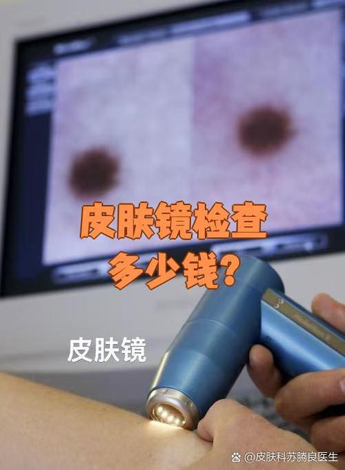 皮肤镜检查大概多少钱游戏截图