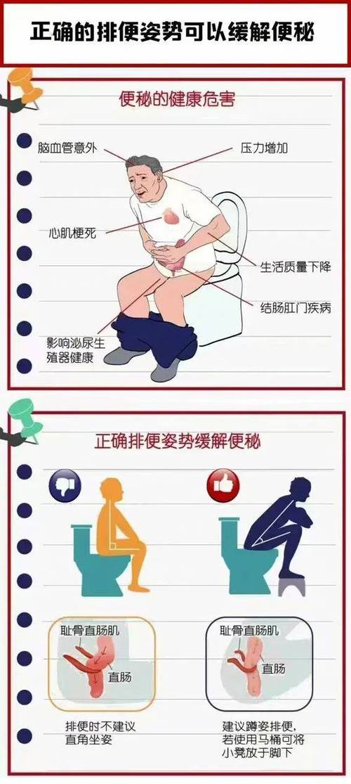 治疗便秘的方法缩略图