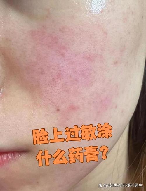 脸过敏可以涂什么游戏截图