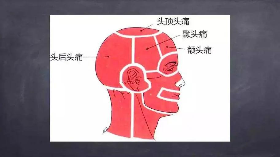 怎么缓解头痛最快图标