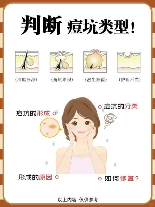 痘坑的形成原因缩略图